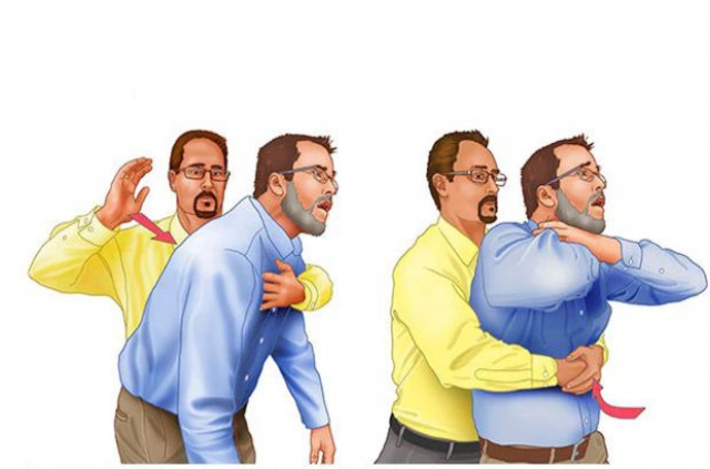 Hayat Kurtaran Heimlich Manevrası Nedir? Nasıl Yapılır?